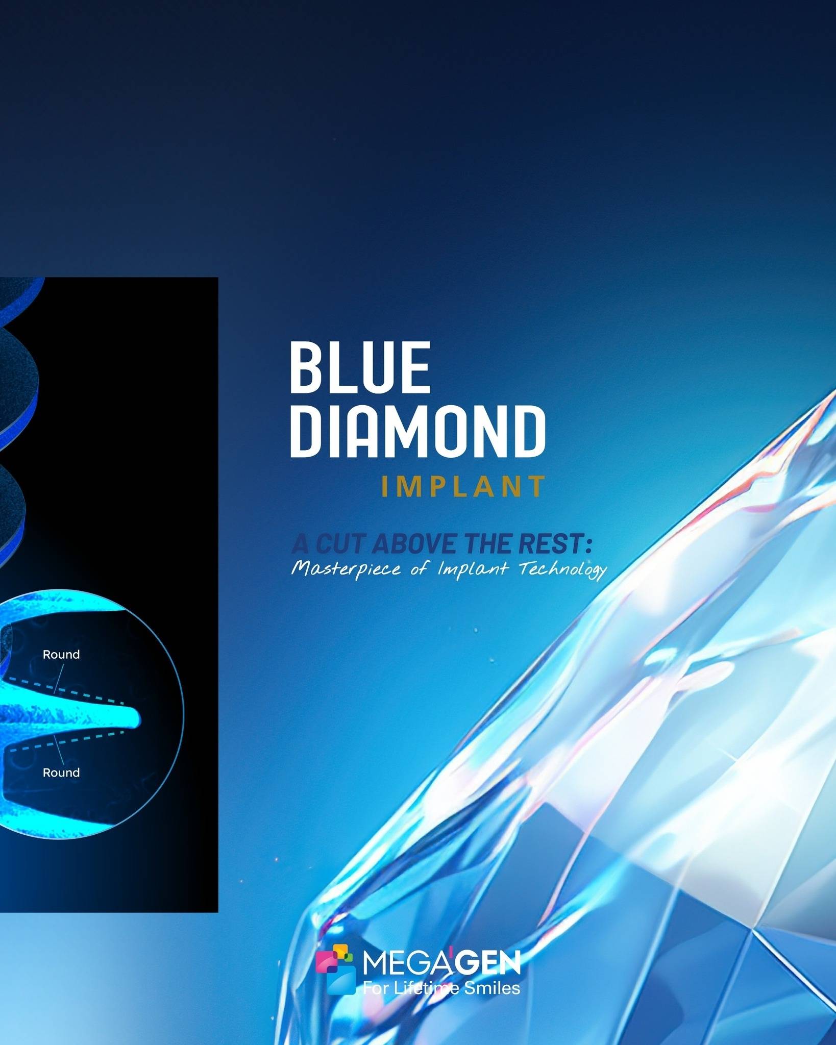 Megagen Blue Diamond Dental Implants in pakistan