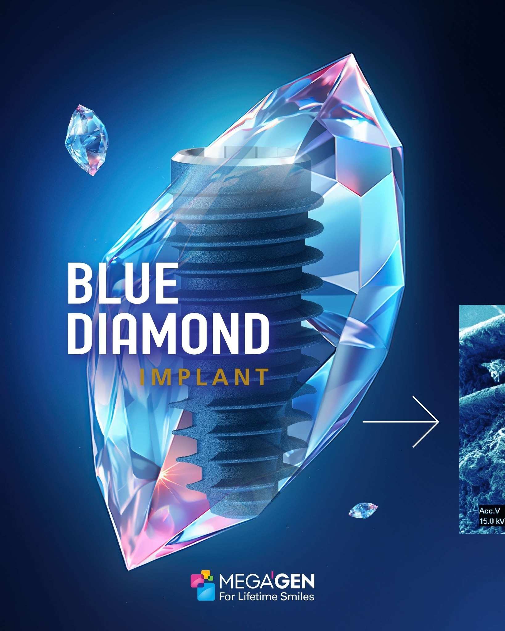 Megagen Blue Diamond Dental Implant Details