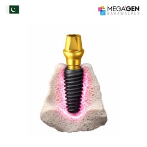 ST Implant System